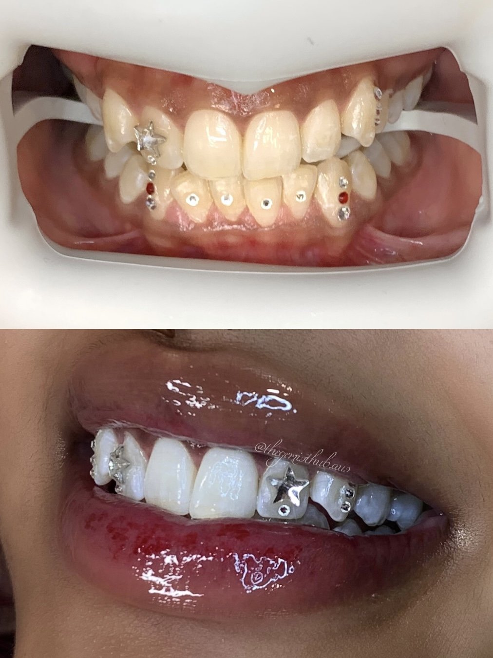 Gold charm tooth gem